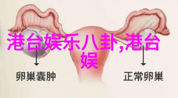 在手机屏幕上电视剧真探第四季的剧照悄然曝光朱迪福斯特和卡莉瑞斯将如何在雪地中揭开谜团
